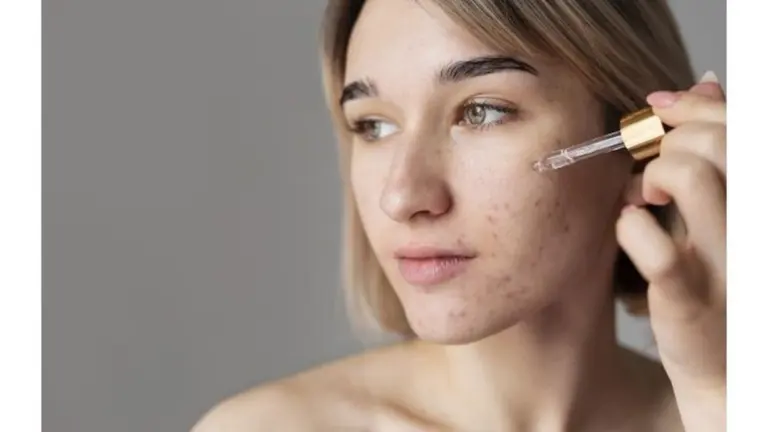 Proč dermatologové varují před vysoušením pupínků lihem