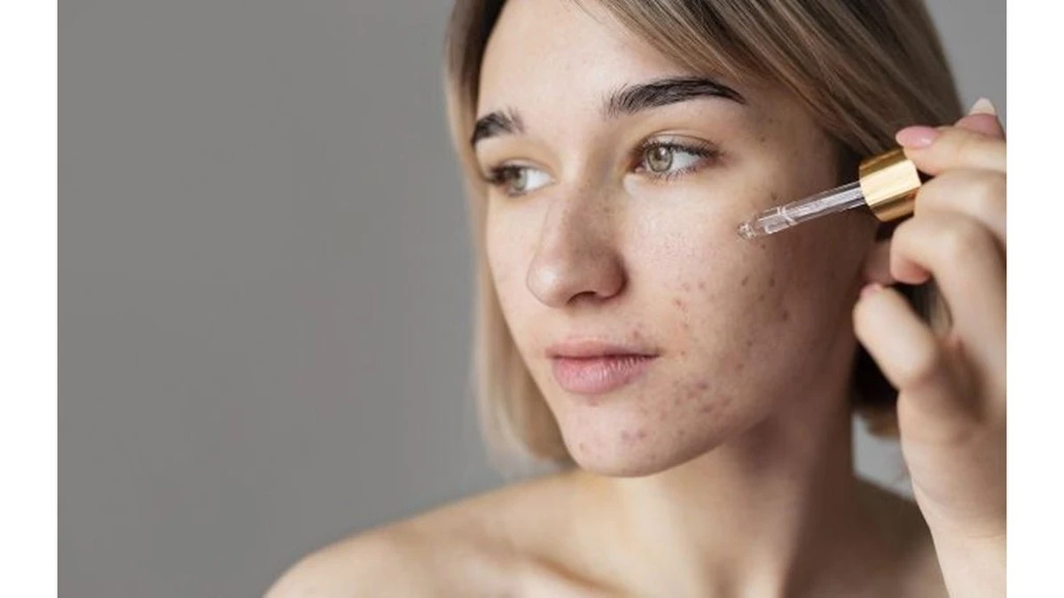 Proč dermatologové varují před vysoušením pupínků lihem